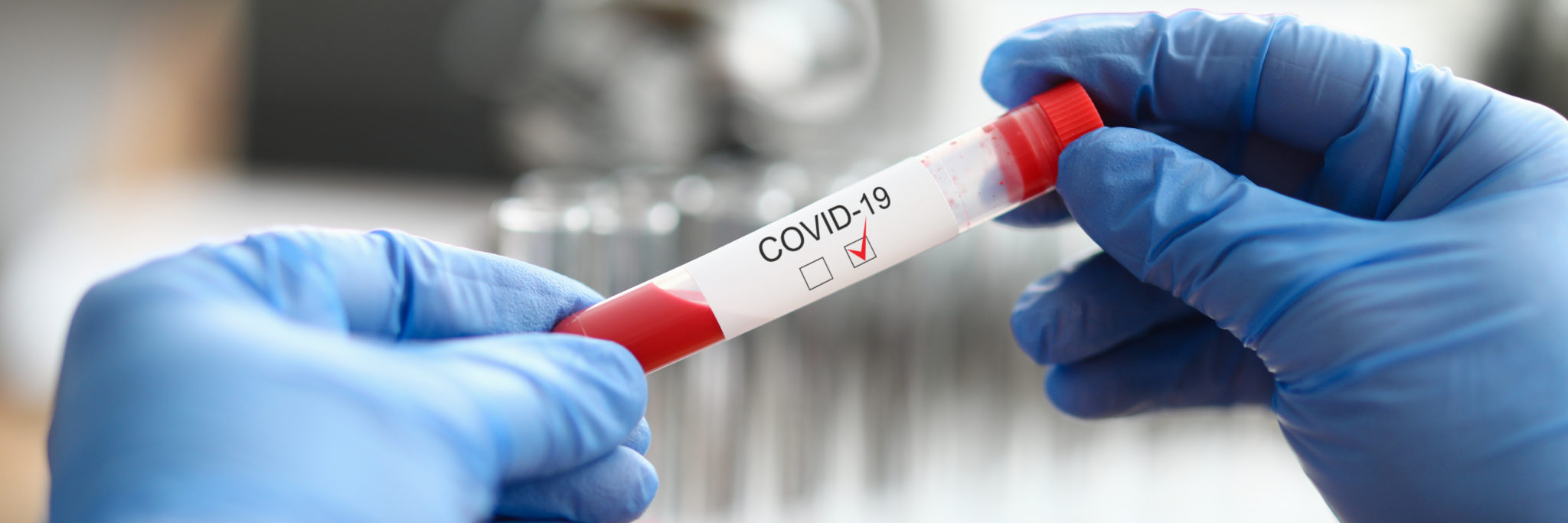 uk-covid-19-pcr-test-for-travel-tried-and-tested-which-should-you