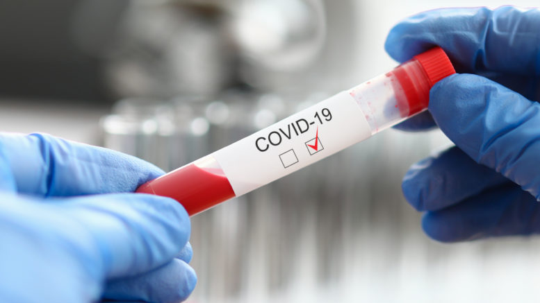 UK COVID19 PCR Test for travel tried and tested which